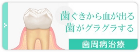 歯茎から血が出る、歯がグラグラする